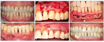 2016口腔醫(yī)師資格考試-口組-牙周膜 2016口腔醫(yī)師資格考試-口組-牙周膜