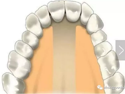 特殊植入部位及注意事項(xiàng) 特殊植入部位及注意事項(xiàng)