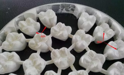 全鋯牙冠裂原因分析&mdash;操作流程工藝以及患者日常使用