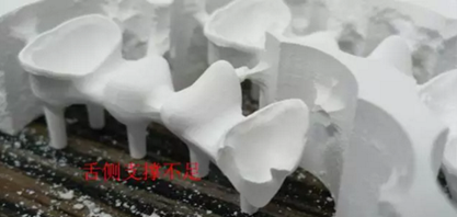 全鋯牙冠裂原因分析&mdash;操作流程工藝以及患者日常使用