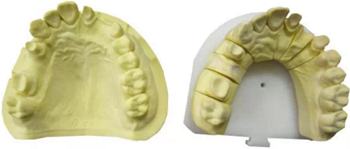 【分享】高水平義齒制作工藝流程 【分享】高水平義齒制作工藝流程