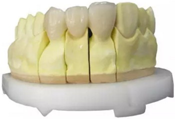 【分享】高水平義齒制作工藝流程 【分享】高水平義齒制作工藝流程