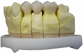 【分享】高水平義齒制作工藝流程 【分享】高水平義齒制作工藝流程