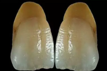 【分享】高水平義齒制作工藝流程 【分享】高水平義齒制作工藝流程