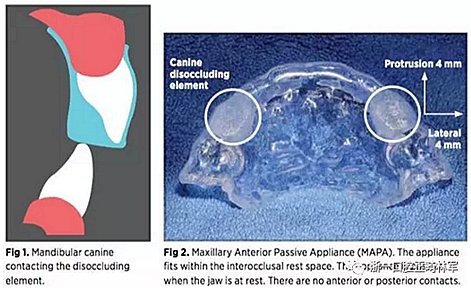 正畸文獻閱讀--剖析合板part 2 正畸文獻閱讀--剖析合板part 2