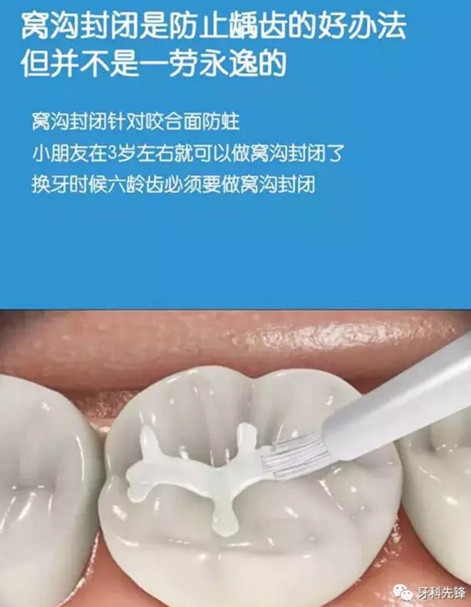 0~6歲寶寶口腔知識干貨集錦 0~6歲寶寶口腔知識干貨集錦