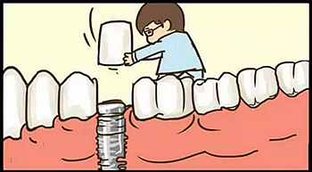 【牙齒種植】健康牙齒&ldquo;種&rdquo;出來