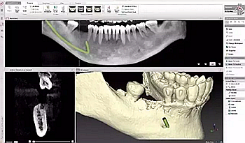 牙疼才去看牙？牙科最良心科普都在這里了！