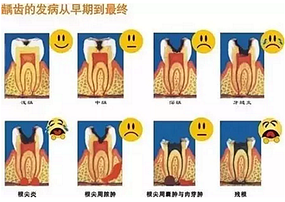 為什么有些牙齒，醫(yī)生不給我補？