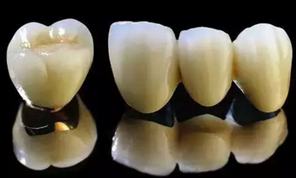 【科普】牙齒根管治療大全 【科普】牙齒根管治療大全