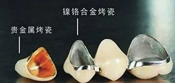 【科普】牙齒根管治療大全 【科普】牙齒根管治療大全