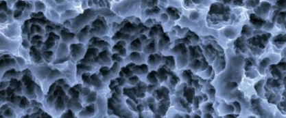 士卓曼ITI種植體到底好在哪？&mdash;&mdash;種植牙行業(yè)淺析