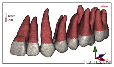 正畸文獻(xiàn)閱讀--對(duì)于滑動(dòng)法關(guān)閉間隙的有限元分析 正畸文獻(xiàn)閱讀--對(duì)于滑動(dòng)法關(guān)閉間隙的有限元分析