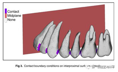 正畸文獻(xiàn)閱讀--對(duì)于滑動(dòng)法關(guān)閉間隙的有限元分析 正畸文獻(xiàn)閱讀--對(duì)于滑動(dòng)法關(guān)閉間隙的有限元分析