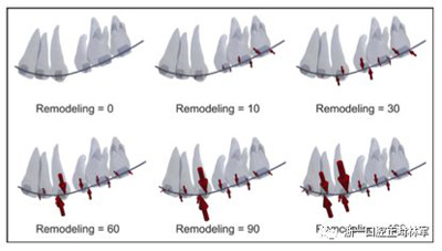 正畸文獻(xiàn)閱讀--對(duì)于滑動(dòng)法關(guān)閉間隙的有限元分析 正畸文獻(xiàn)閱讀--對(duì)于滑動(dòng)法關(guān)閉間隙的有限元分析