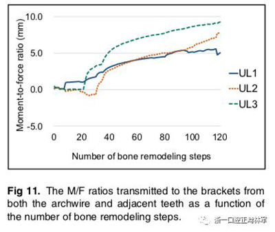 正畸文獻(xiàn)閱讀--對(duì)于滑動(dòng)法關(guān)閉間隙的有限元分析 正畸文獻(xiàn)閱讀--對(duì)于滑動(dòng)法關(guān)閉間隙的有限元分析