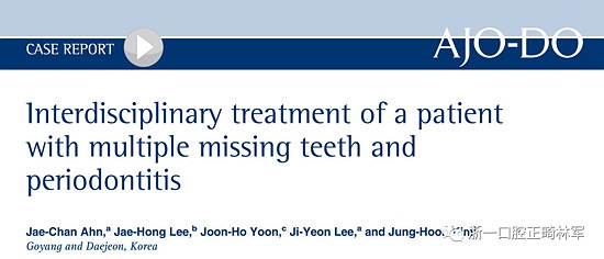 文獻優(yōu)秀正畸病例賞析--多顆牙齒缺失的牙周炎患者的跨學(xué)科綜合治療 文獻優(yōu)秀正畸病例賞析--多顆牙齒缺失的牙周炎患者的跨學(xué)科綜合治療