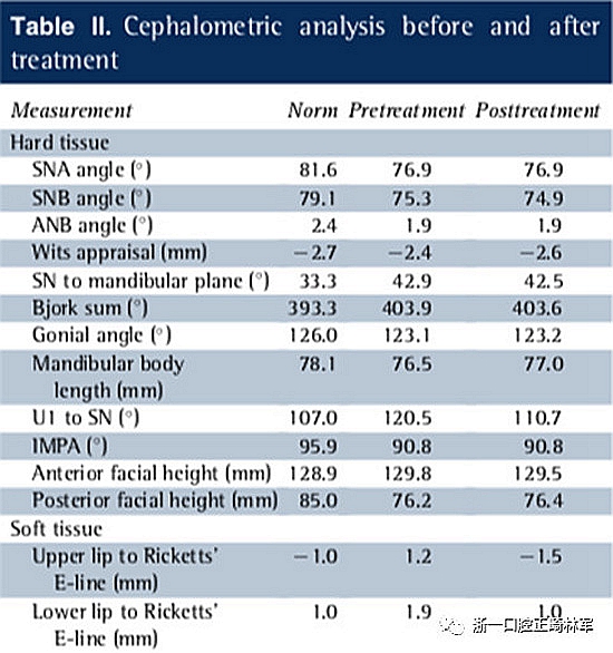 文獻優(yōu)秀正畸病例賞析--多顆牙齒缺失的牙周炎患者的跨學(xué)科綜合治療 文獻優(yōu)秀正畸病例賞析--多顆牙齒缺失的牙周炎患者的跨學(xué)科綜合治療