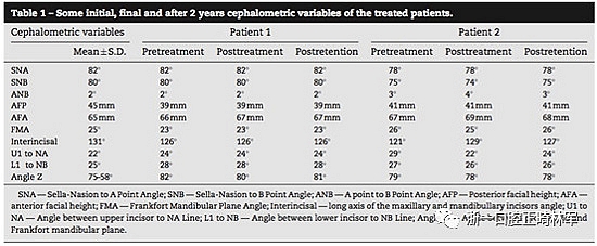 文獻優(yōu)秀正畸病例賞析--同卵雙胞胎使用自鎖托槽和傳統(tǒng)托槽正畸治療比較 文獻優(yōu)秀正畸病例賞析--同卵雙胞胎使用自鎖托槽和傳統(tǒng)托槽正畸治療比較