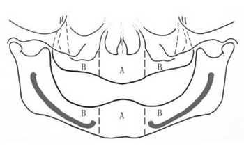 無牙頜種植修復(fù)的檢查與設(shè)計&mdash;&mdash;施斌教授