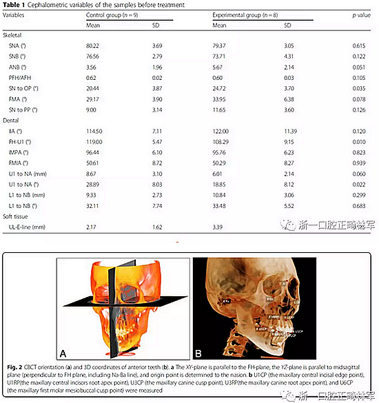 正畸文獻(xiàn)閱讀--用舌側(cè)滑動(dòng)牽引系統(tǒng)控制前牙區(qū)段:初步的CBCT研究 正畸文獻(xiàn)閱讀--用舌側(cè)滑動(dòng)牽引系統(tǒng)控制前牙區(qū)段:初步的CBCT研究