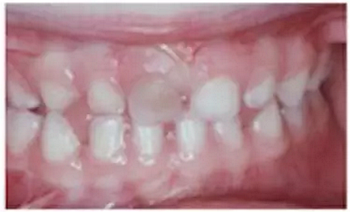 牙疼、磕掉牙、口長皰&hellip;&hellip;這些急救知識你知道嗎？