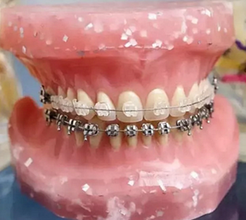 牙疼、磕掉牙、口長皰&hellip;&hellip;這些急救知識你知道嗎？