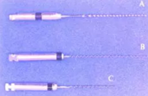 知識分享:根管治療的標(biāo)準(zhǔn)步驟 知識分享:根管治療的標(biāo)準(zhǔn)步驟