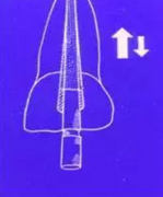 知識分享:根管治療的標(biāo)準(zhǔn)步驟 知識分享:根管治療的標(biāo)準(zhǔn)步驟