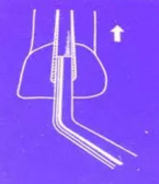 知識分享:根管治療的標(biāo)準(zhǔn)步驟 知識分享:根管治療的標(biāo)準(zhǔn)步驟