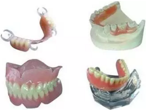 活動義齒的注意事項有哪些 活動義齒的注意事項有哪些