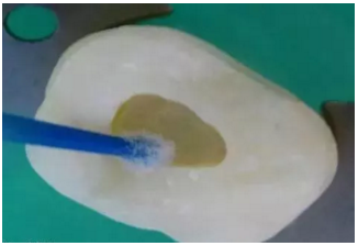 詳細(xì)了解自酸蝕、全酸蝕