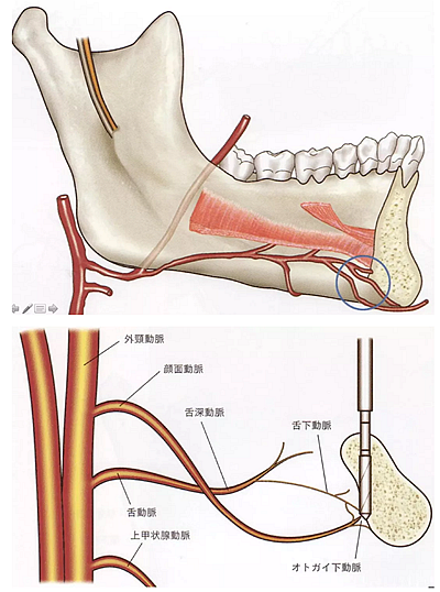 種植手術(shù)的12個(gè)重要操作 種植手術(shù)的12個(gè)重要操作