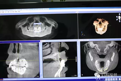 【原創(chuàng)博客】烤瓷橋下的悲劇-張東星 【原創(chuàng)博客】烤瓷橋下的悲劇-張東星