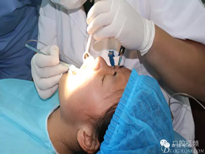 【原創(chuàng)博客】烤瓷橋下的悲劇-張東星 【原創(chuàng)博客】烤瓷橋下的悲劇-張東星