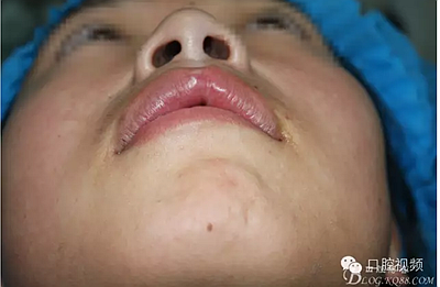 【原創(chuàng)博客】烤瓷橋下的悲劇-張東星 【原創(chuàng)博客】烤瓷橋下的悲劇-張東星