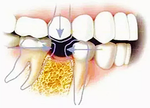 你總?cè)轮囱?ldquo;貴”還不是你自己造成的 你總?cè)轮囱?ldquo;貴”還不是你自己造成的