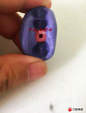 種植導板制作 種植導板制作