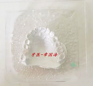 種植導板制作 種植導板制作