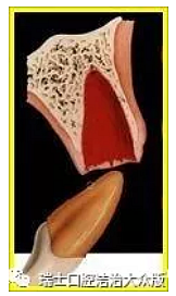 成人牙齒外傷了怎么應急處理？