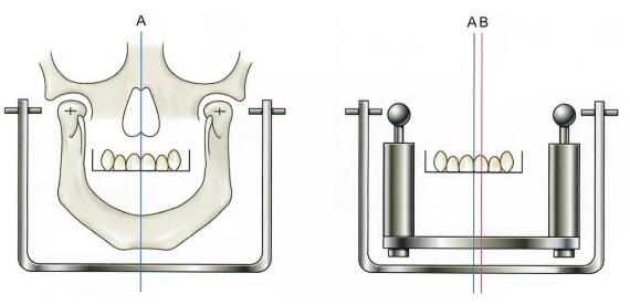 面弓實(shí)際應(yīng)用上的問題 面弓實(shí)際應(yīng)用上的問題
