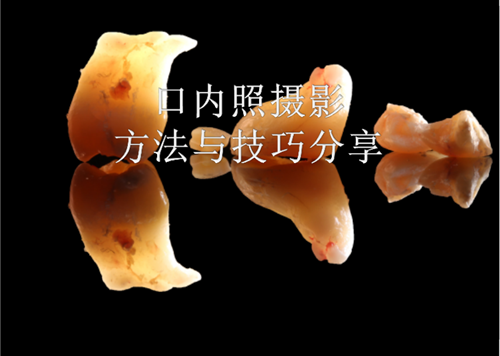 口內(nèi)照攝影方法與技巧分享 口內(nèi)照攝影方法與技巧分享
