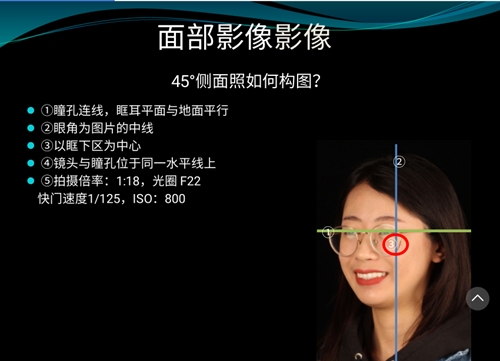 口內(nèi)照攝影方法與技巧分享 口內(nèi)照攝影方法與技巧分享