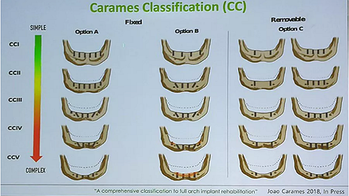 【熱點回顧】帶您深度了解無牙頜種植修復(fù)——Pro Arch 【熱點回顧】帶您深度了解無牙頜種植修復(fù)——Pro Arch