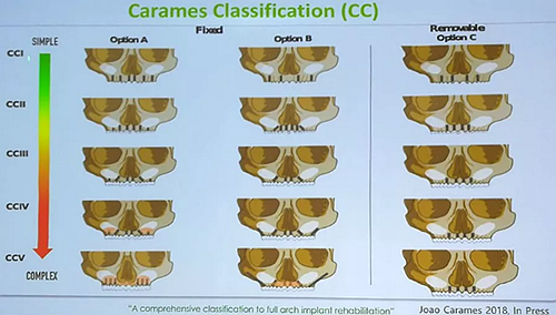 【熱點回顧】帶您深度了解無牙頜種植修復(fù)——Pro Arch 【熱點回顧】帶您深度了解無牙頜種植修復(fù)——Pro Arch