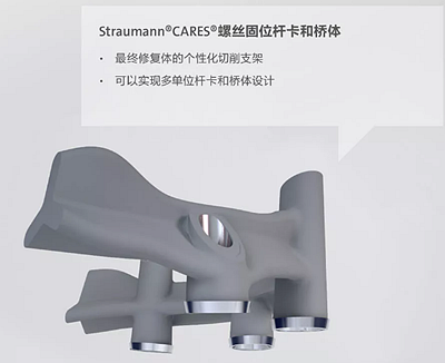 【熱點回顧】帶您深度了解無牙頜種植修復(fù)——Pro Arch 【熱點回顧】帶您深度了解無牙頜種植修復(fù)——Pro Arch