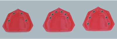 【熱點回顧】帶您深度了解無牙頜種植修復(fù)——Pro Arch 【熱點回顧】帶您深度了解無牙頜種植修復(fù)——Pro Arch