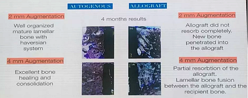【聽(tīng)課筆記】種植體周?chē)浻步M織相關(guān)美學(xué)考量因素 【聽(tīng)課筆記】種植體周?chē)浻步M織相關(guān)美學(xué)考量因素