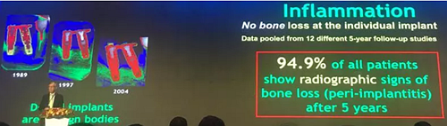 【聽課筆記】種植體周圍骨吸收因素研究與臨床意義 【聽課筆記】種植體周圍骨吸收因素研究與臨床意義