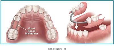 兒童早期矯治問(wèn)題 兒童早期矯治問(wèn)題